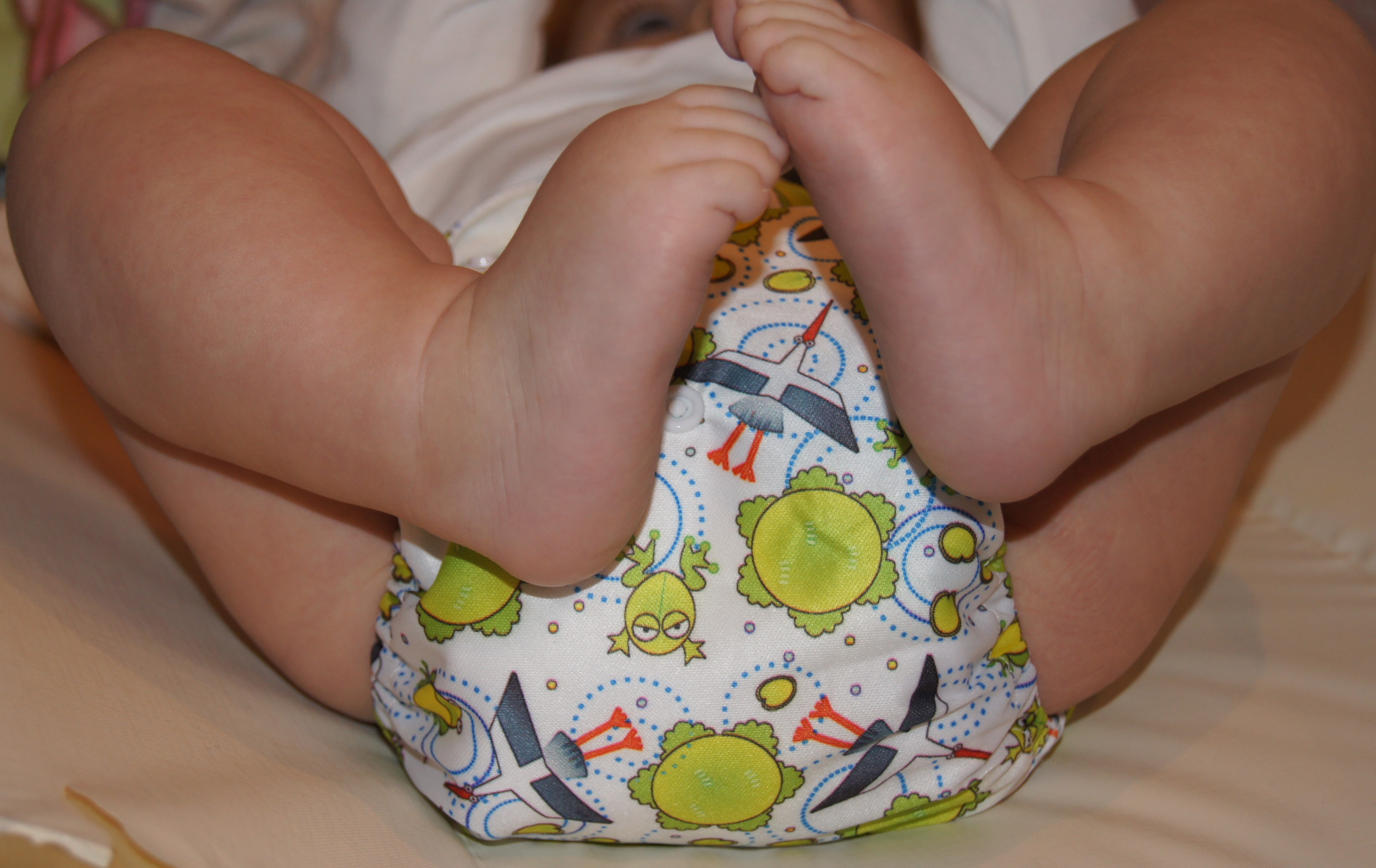 alergia pampers pants